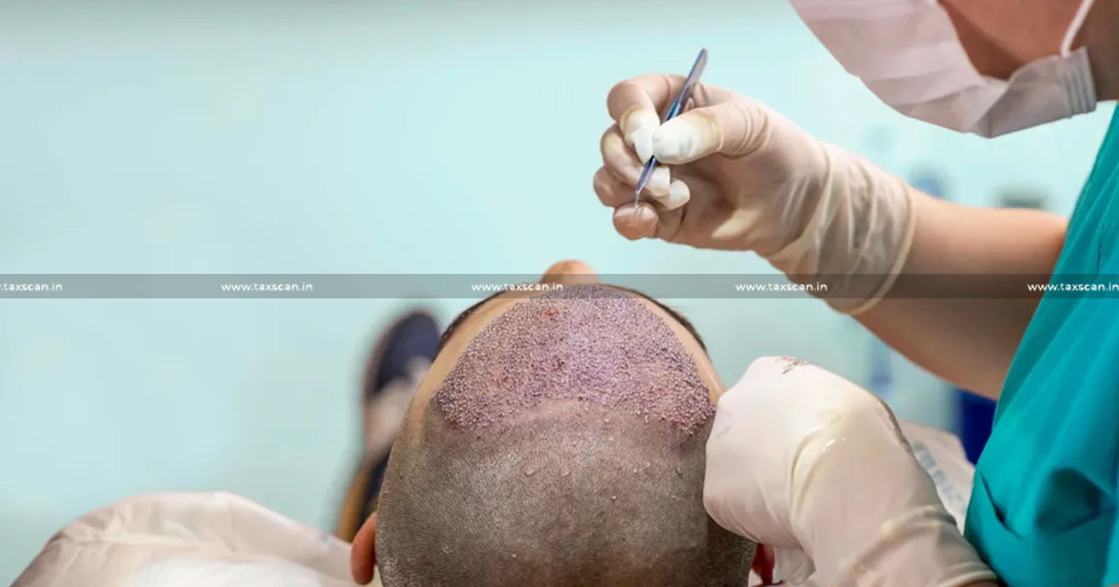 Hair Transplant - Cosmetic Surgery - Service Tax - CESTAT - Customs - Excise - Taxscan